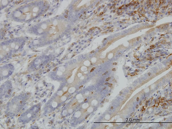 Monoclonal Mouse anti-Human BAR / BFAR Antibody (clone 1C6, IHC, WB)