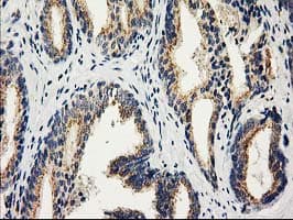 CAT / Catalase Antibody (clone 1B6, Carrier-free)