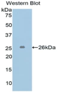 L1CAM Antibody (aa218-423, Biotin)