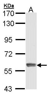 Polyclonal Rabbit anti-Human IFIT3 Antibody (aa230-490, IHC, WB)
