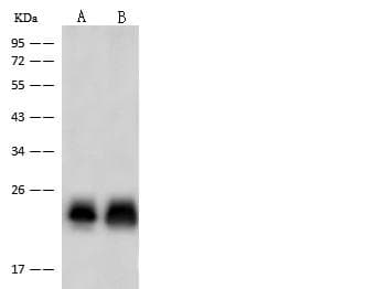 Polyclonal Rabbit anti-Human TNNI2 Antibody (Preservative Free, IHC, IF, WB)