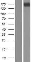 CPS1 Protein (Over-Expression Lysate Myc-DDK (Flag))