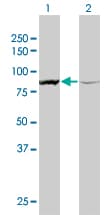 Monoclonal Mouse anti-Human ACTN1 Antibody (clone 3F1, WB)