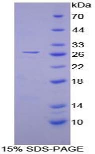 Human CAMK2G / CaMK II Gamma Protein (Recombinant His-T7)