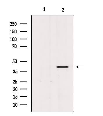 Polyclonal Rabbit anti-Human PGC / Pepsin C Antibody (IHC, IF, WB)