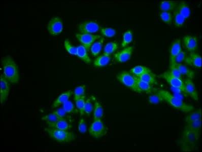 ZDHHC14 Antibody