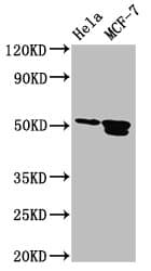 TFAP2B / AP2 Beta Antibody