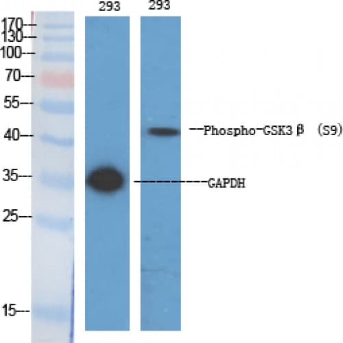 Polyclonal Rabbit anti-Human GSK3B / GSK3 Beta Antibody (1-80 aa, IHC, WB)