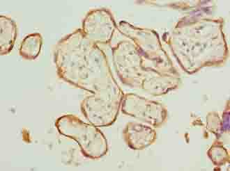 CAPN6 / Calpain 6 Antibody