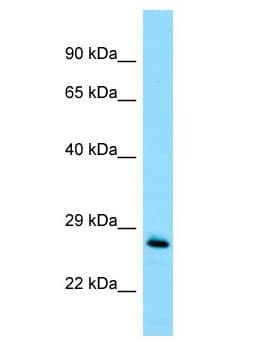 Polyclonal Rabbit anti-Human MOB1A Antibody (aa81-130, WB)