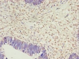 PRTFDC1 / HHGP Antibody (aa2-225, FITC)