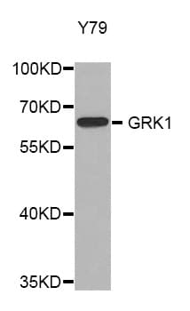 Polyclonal Rabbit anti-Human Rhodopsin Kinase / GRK1 Antibody (IHC, WB)