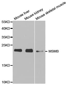 PathPlus™ MSMB / MSP Antibody