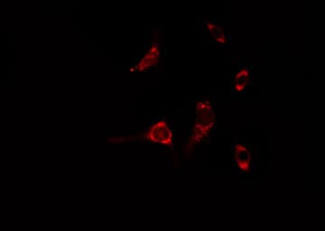Polyclonal Rabbit anti-Human RAB6A / RAB6 Antibody (IF, WB)