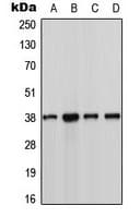 CSNK1A1 / CK1 Alpha Antibody (Internal)