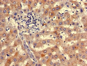 Polyclonal Rabbit anti-Human IDN3 / NIPBL Antibody (IHC)