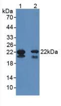 GPX4 / MCSP Antibody (aa74-197)