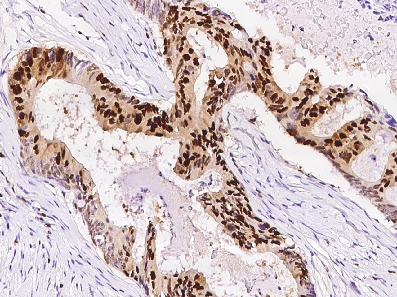 Monoclonal Rabbit anti-Human PCNA Antibody (clone 144, Preservative Free, IHC)