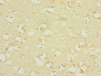 DNAJC19 Antibody