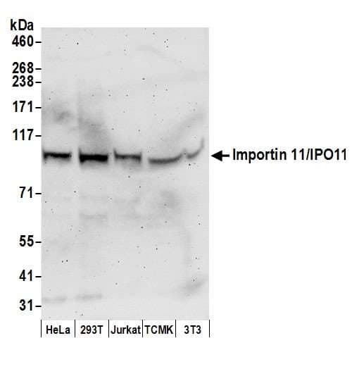 Polyclonal Rabbit anti-Human IPO11 / Importin 11 Antibody (aa925-975, WB)