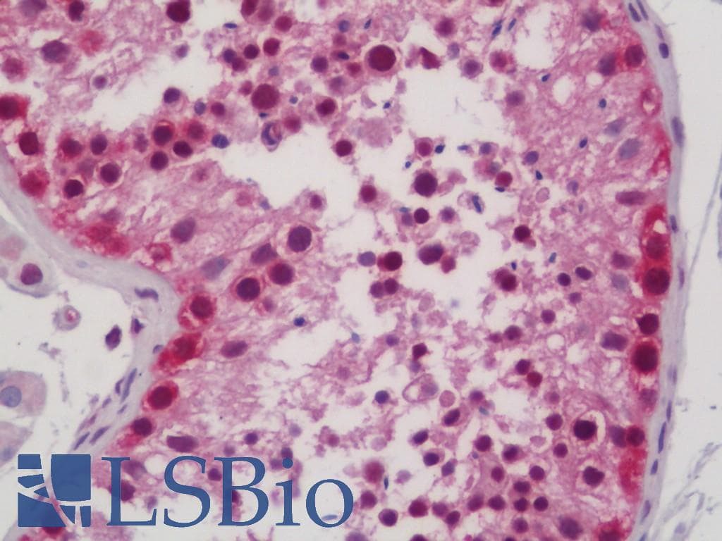 IHC-plus™ RAPGEF5 / GFR Antibody (aa417-466)