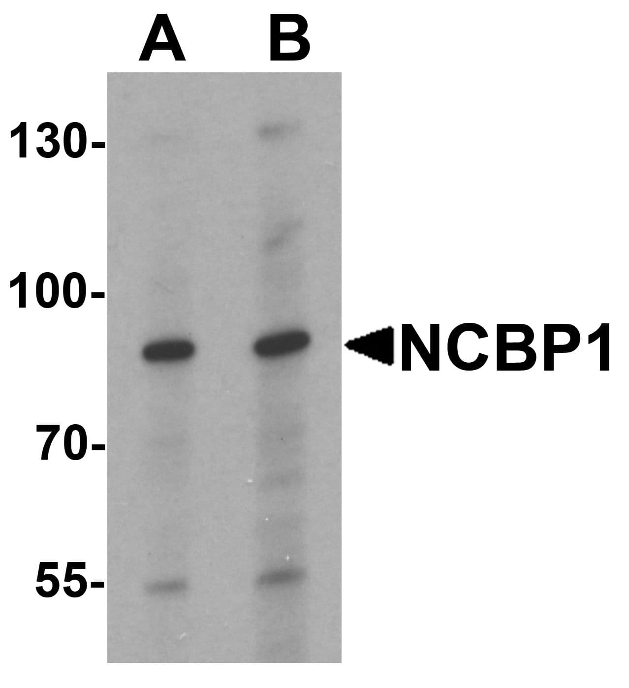 IHC-plus™ Polyclonal Rabbit anti-Human NCBP1 / CBP80 Antibody (IHC, WB)