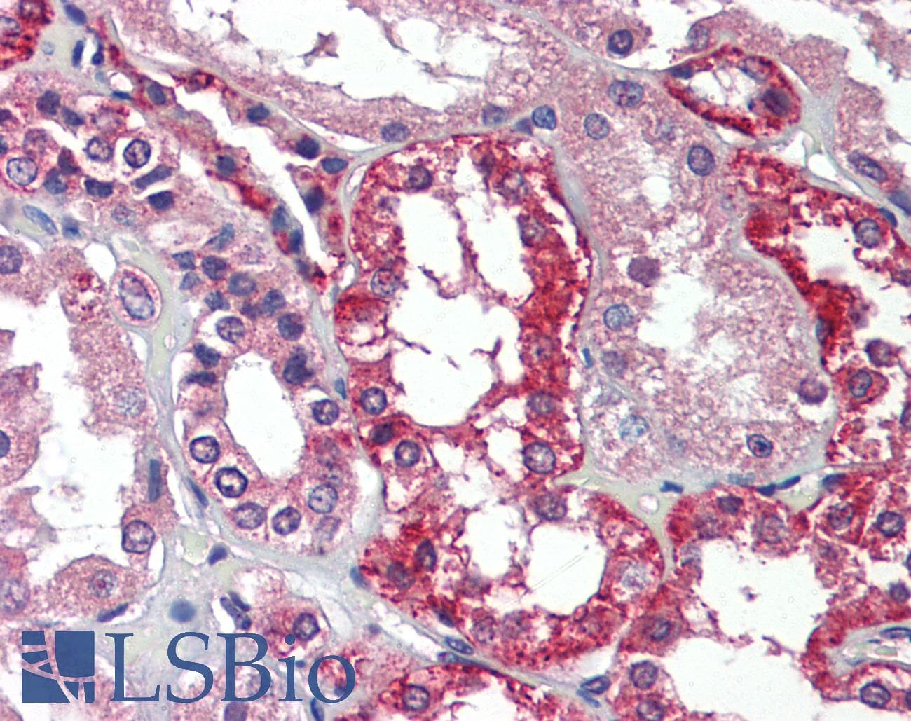 IHC-plus™ Polyclonal Rabbit anti-Human AGPS Antibody (IHC, WB)