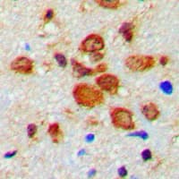 TH / Tyrosine Hydroxylase Antibody (phospho-Ser19)