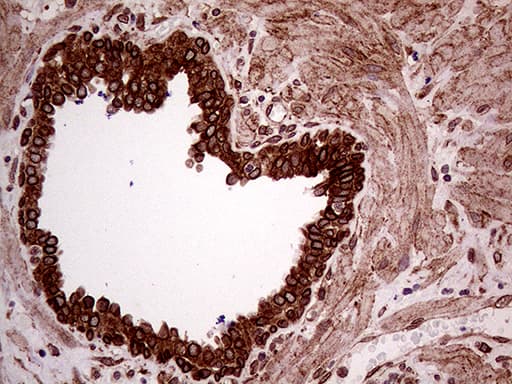 Monoclonal Mouse anti-Human ERLIN1 / SPFH1 Antibody (clone OTI4B1, aa107-346, IHC, WB)