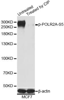 POLR2A / RNA polymerase II Antibody (phospho-Ser5)