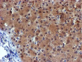 Monoclonal Mouse anti-Human Mannose Phosphate Isomerase Antibody (clone OTI4E7, IHC, WB)