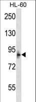 MCPH1 Antibody (aa104-133)
