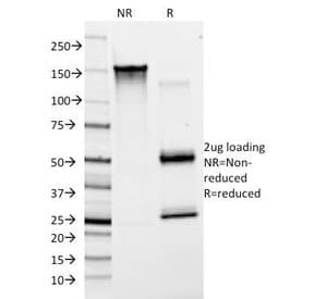 Monoclonal Mouse anti-Human VWF / Von Willebrand Factor Antibody (clone F8/86, Azide-free,BSA-free, IHC, IF)