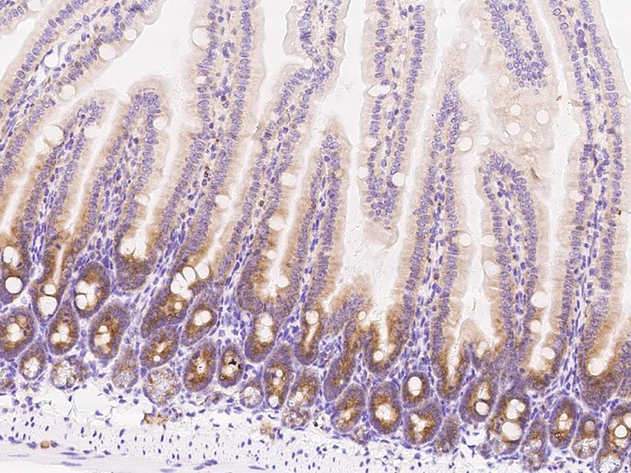 METAP2 Antibody (Preservative Free)