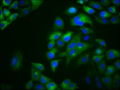 OTOP1 Antibody