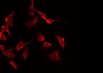 PRKAR2B Antibody