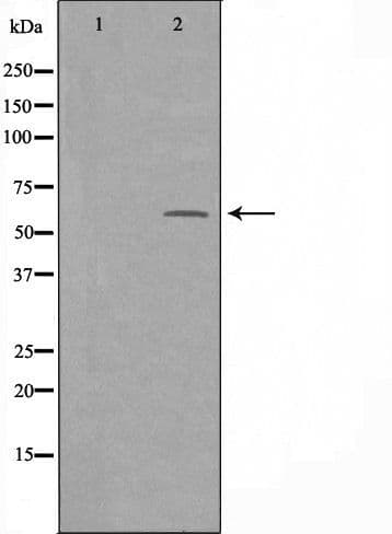Polyclonal Rabbit anti-Human SNX4 Antibody (WB)