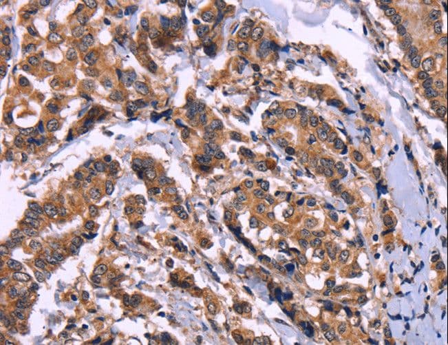 Polyclonal Rabbit anti-Human AMIGO2 Antibody (IHC, WB)