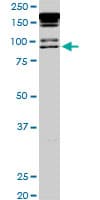 Monoclonal Mouse anti-Human PML Antibody (clone 1D12, IF, WB)