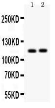 ATP2A2 / SERCA2 Antibody (aa1-32)