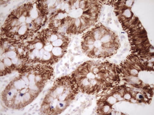 CALCA Antibody (clone 2D10)