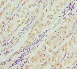 Polyclonal Rabbit anti-Human PACSIN2 Antibody (IHC, WB)
