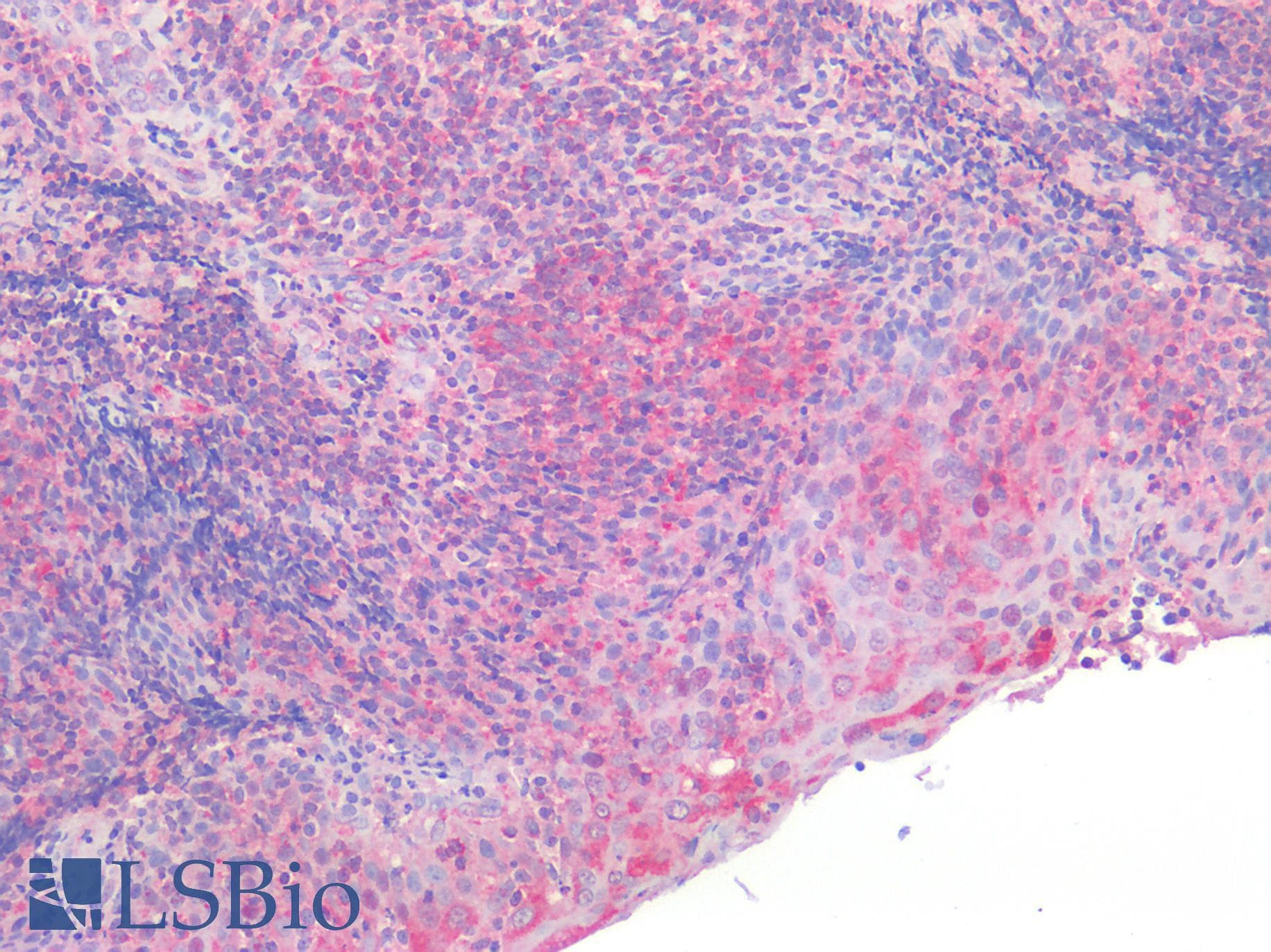 IHC-plus™ CYLD Antibody (clone 1667CT857.3.6.1)