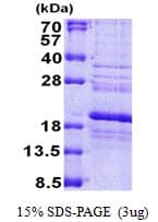Human RPS24 / Ribosomal Protein S24 (Recombinant His)