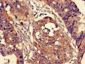 CUTA Antibody
