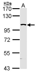 MAP4K5 Antibody (aa417-482)