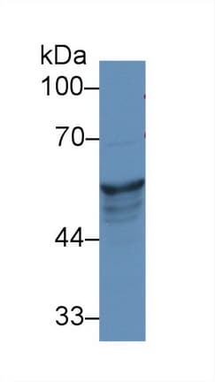 KRT8 / CK8 / Cytokeratin 8 Antibody (aa260-398)