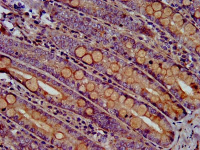 ARHU / RHOU Antibody