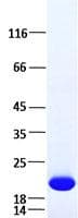 Human IL6 / Interleukin 6 Protein (Recombinant)