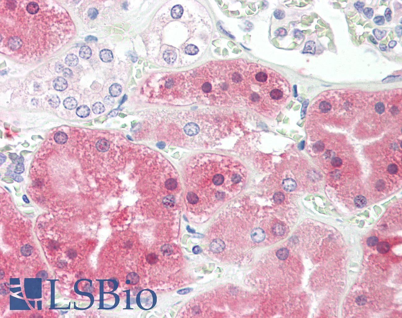 IHC-plus™ PH / PAH Antibody (aa66-76)